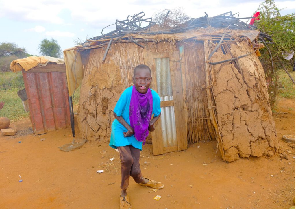 Barn med funktionsvariation framför sitt hem i massajområdet Mashuru, Kenya